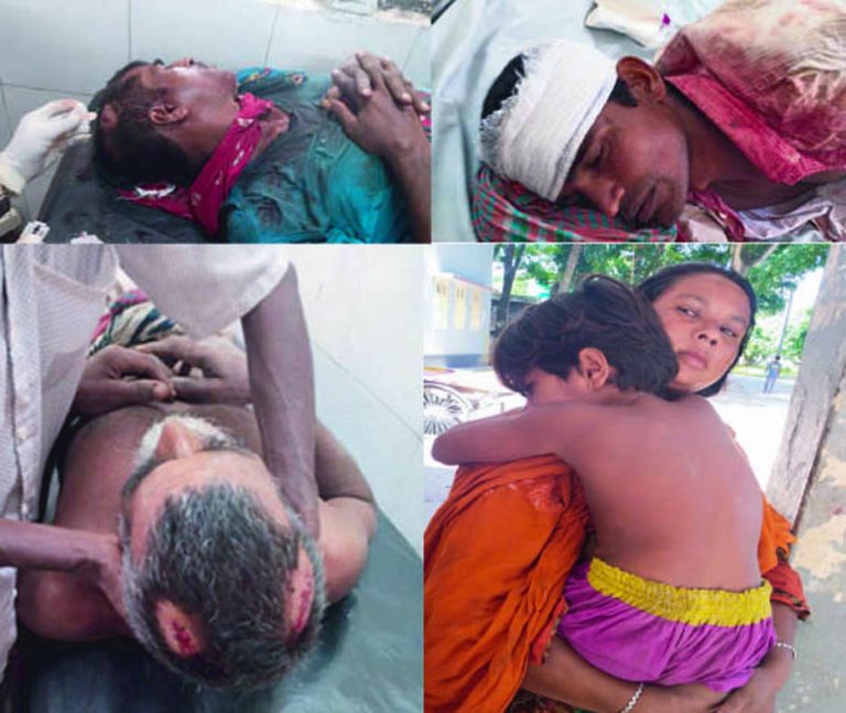 সাঁথিয়ায় জমিজমার বিরোধে রক্তক্ষয়ী সংঘর্ষ ॥ নারী ও শিশুসহ আহত ১০